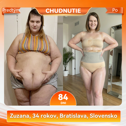 Oficiálny značkový butik | 🌏𝑷𝑬𝑨𝑹𝑳𝑴𝑶𝑶𝑵® 2026 4 v 1 tvarujúce a spaľujúce kraťasy s mikročasticami z MORINGY A BERBERÍNU