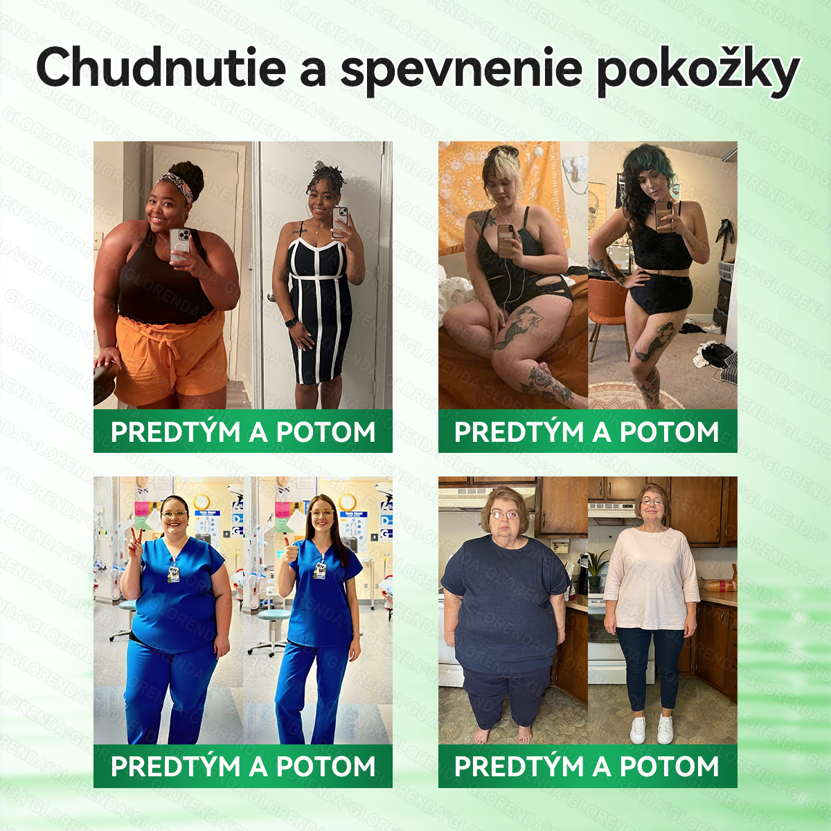 Oficiálny obchod | 🔥 𝑮𝑳𝑶𝐑𝐄𝐍𝐃𝘼® Moringa · Berberín × NAD+ 10 v 1 Pokročilá nano náplasť s mikroihličkami (len raz denne, viditeľné výsledky už po 7 dňoch) 🔥 Pre osoby s obezitou, povolenou pokožkou, cukrovkou a problémami so kĺbmi