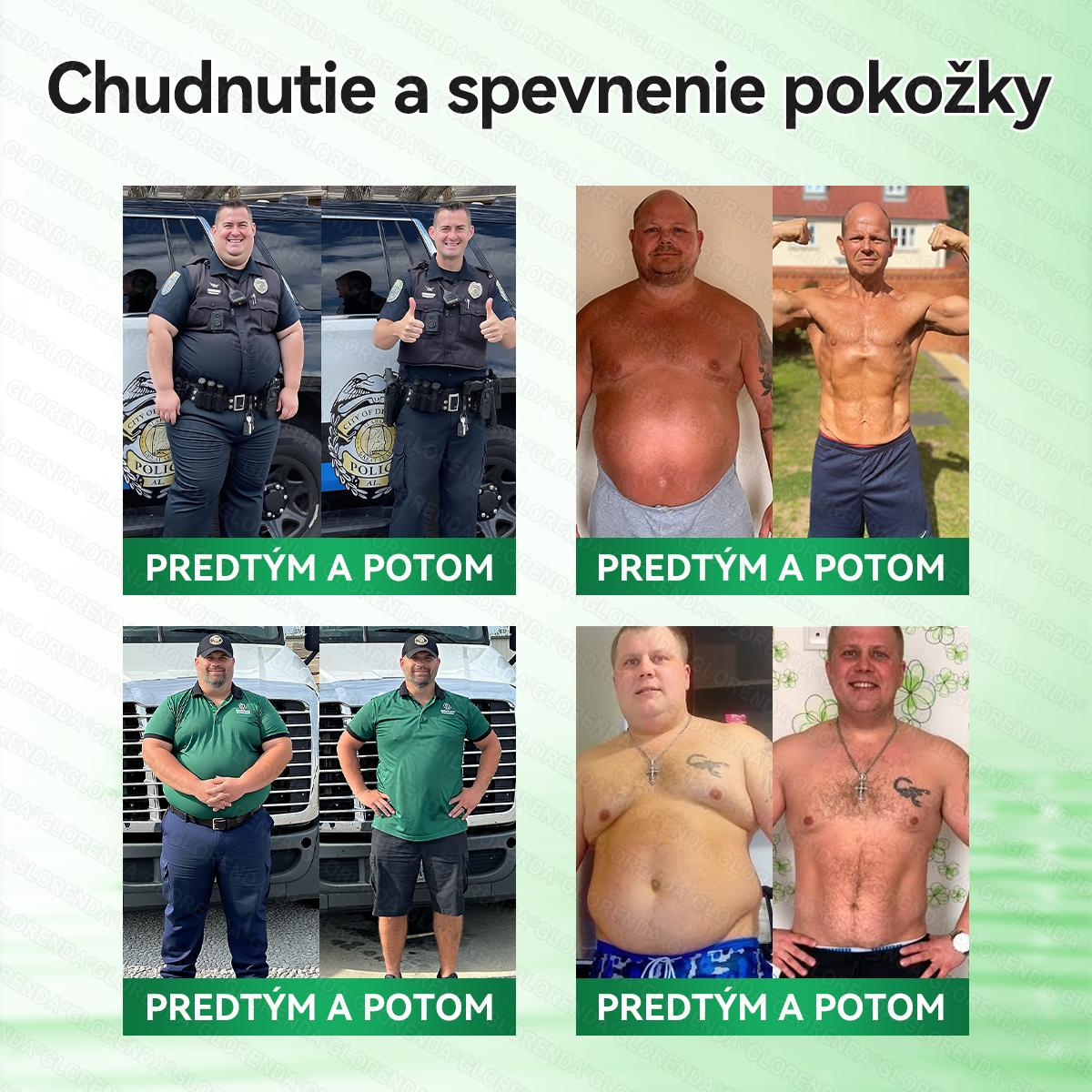Oficiálny obchod | 🔥 𝑮𝑳𝑶𝐑𝐄𝐍𝐃𝘼® Moringa · Berberín × NAD+ 10 v 1 Pokročilá nano náplasť s mikroihličkami (len raz denne, viditeľné výsledky už po 7 dňoch) 🔥 Pre osoby s obezitou, povolenou pokožkou, cukrovkou a problémami so kĺbmi