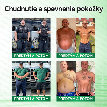Oficiálny obchod | 🔥 𝑮𝑳𝑶𝐑𝐄𝐍𝐃𝘼® Moringa · Berberín × NAD+ 10 v 1 Pokročilá nano náplasť s mikroihličkami (len raz denne, viditeľné výsledky už po 7 dňoch) 🔥 Pre osoby s obezitou, povolenou pokožkou, cukrovkou a problémami so kĺbmi
